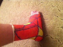 Прошлой осенью в таком вот гипсе два месяца жил, щиколотка поломалась:)
Раскрашивал три часа по пьяни