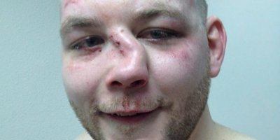 Тот случай, когда и лицом не разблокировать и цифровой код из башки выбили. Чо тогда?!