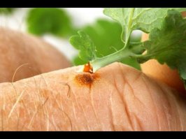 Да-да-да, про уксусную эссенцию я тоже слышал.
Правда говорят, что могут шрамы остаться. Надо очень аккуратно наносить.
у ВАС не растёт это где? В  Заполярье?
Я чистотел видел даже на крайних северах....