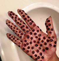 Да от этой фоточки кожа шевелиться начинает. Но если присмотреться, то это вовсе не болячка, а что-то вроде теста.