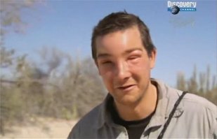 Родители отказались от больного ребенка, но посмотрите на него 30 лет спустя!