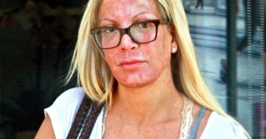 А что случилось с ее лицом?