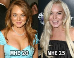 Известная иб.анушка, здоровье угробила