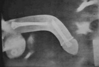 Лекция в институте. Профессор:
- Как выглядит член мужчины? Ну вот вы, девушка, расскажите.
Девушка, стесняясь и краснея:
- Мне показалось, что это такая кость сантиметров тридцать длиной...
Профессор:
- Насчет кости вам действительно прказалось, а в остальном повезло.