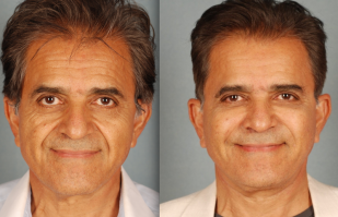 Это 41 летний???