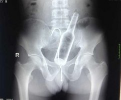 В миллиметре от позора)