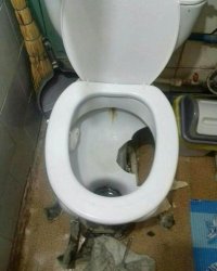 Камни из почки выходили туго...