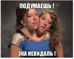 В Индии появился на свет младенец с двумя головами