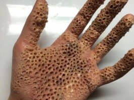 Страшный сон трипофоба.