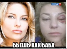 WTF? Что значит бьет?
Разве не так все происходит?)))