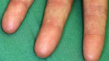 Фу-у-у! Лана пост открыл, а то подумал: "мля, какие коленки у девки!", а оно вона чо, Михалыч! Лана не потеребонькал.