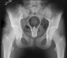 Вы и представить не могли, что такое можно сделать из перегоревшей лампочки. Гениально!