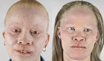 И ещё чуть альбиносов.