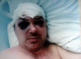 Мы очень легко забываем, а надо помнить об этой одной. Тоже ничего, кстати. Тоже, небось, красовалась на лошадке.