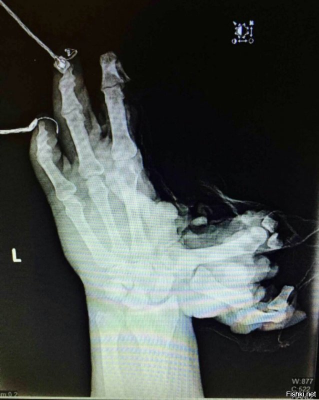 За пост + однозначно! 
Чья то МАМА не будет плакать 1 января.
С наступающим!