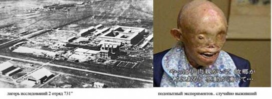 А в это время ну или чуть раньше генерал-лейтенант Императорской армии Японии некто Сиро Исии проводил такие опыты над живыми людьми, по сравнению с которыми опыты Менгеле выглядят детскими забавами.
