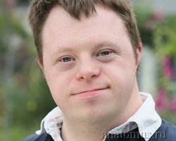 Когда мэр города - дебил