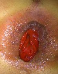 ГУБЫ КАК ЧКО!