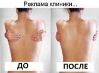 Чечню охватила эпидемия пластики