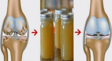 Желатин,он же - коллаген,очень полезен для суставов,кожи и др. Каждый день нужно принимать 5-10 грамм желатина.