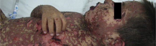 Вообщем то о такой мебели надо знать только одно!

......"Вреднейшие для здоровья вещества выделяются из покрышек уже просто при их хранении в помещении -  на складах, гаражах, заводах. Не случайно, как показывают исследования, работники шинных заводов в несколько раз чаще подвержены онкологическим и аллергическим заболеваниям. Самое время упомянуть о том, что ни в коем случае нельзя хранить комплекты шин в квартире   на балконе, на антресолях, в шкафах. К сожалению, некоторые граждане умудряются проделывать это со сменными комплектами покрышек, а затем обнаруживают у себя непроходящий кашель или другие неприятности со здоровьем.".....