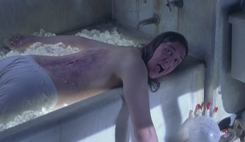 Муж втайне от жены продал ее почку: "У тебя было слишком маленькое приданое!"