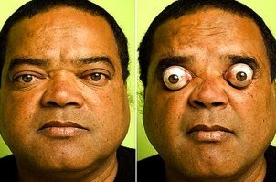 А еще можно попробовать выдвинуть глаза подальше...