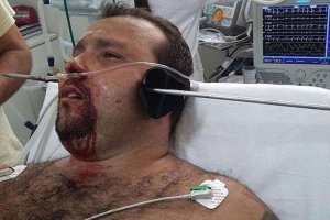 Мужик легко отделался ещё по сравнению с этим