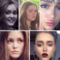 Господи, какое кэпство. Ну блин, она такая-же дура как все остальные. Стандартная мода, стандартные операции. Они все стали одинаковые и имя им - легион. Носик утоньшить, в скулы и губы филлеры, и вуаля.