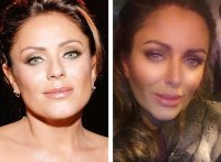 Господи, какое кэпство. Ну блин, она такая-же дура как все остальные. Стандартная мода, стандартные операции. Они все стали одинаковые и имя им - легион. Носик утоньшить, в скулы и губы филлеры, и вуаля.