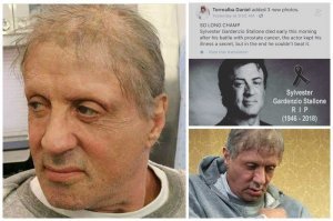 Дерьмовый фотожоп. Волос убавили, а форма лица прежняя. Видимо никогда не видели реальных людей, страдающих онко заболеваниями.