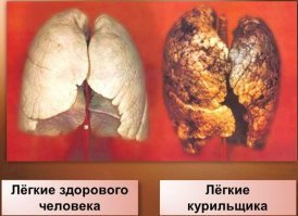Это мем.
Началось с картинок про вред курения (на пачках сигарет которые)
Потом идею подхватили и перенесли противопоставление "хороший-плохой" на другие сферы жизни, оставив формулировку "Z здорового человека - Z курильщика".