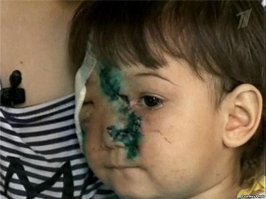 Да, конечно, ми-ми-ми. но есть и: