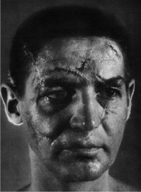 Вот что значит без маски стоять на воротах.