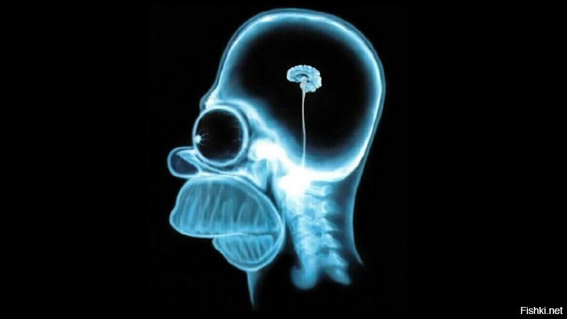Как в голове мужчины обнаружили воздух на месте мозга