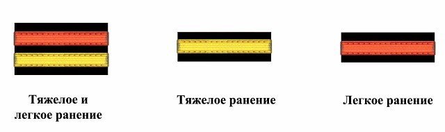 Ой, как верно! Дизлайки в лучшем случае выглядят так....