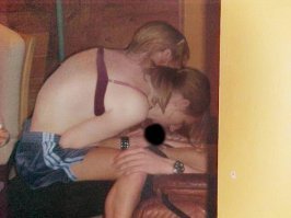 Разделение сиамских близнецов - жизнь до и после