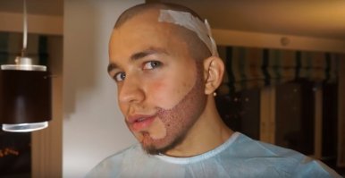 Пересадите ему бороду, как актёру с кухни, может поможет.