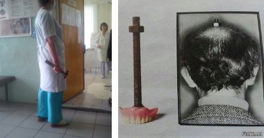 Странный стоматолог