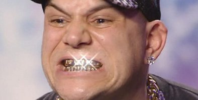 Самые завидные зубы, с точки зрения провинциалов?