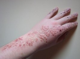 Особенно в таком виде, вашпе удивительно!