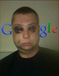 Фотограф после нападения с воздуходувкой