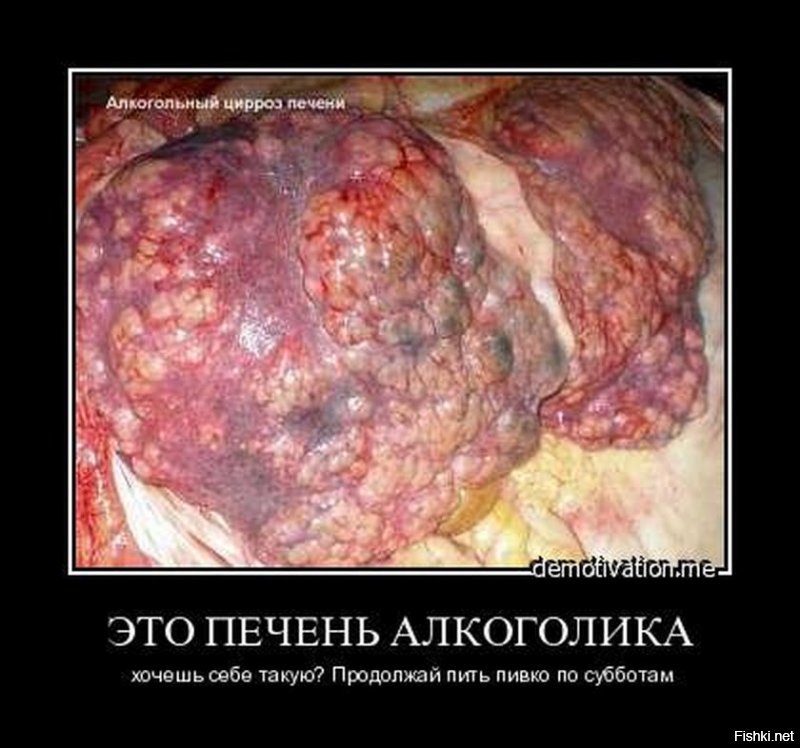 вот правильное сочетание )))