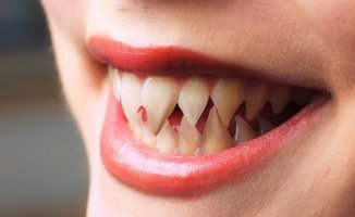 В Индонезии поймали рыбу с человеческими зубами