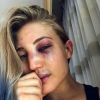 Екатерина Ковалева и Анастасия Янькова до и после боя.

Не бабское это дело.