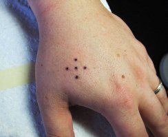 Британец обнаружил странные точки на стопе, и его жестоко затроллили в сети