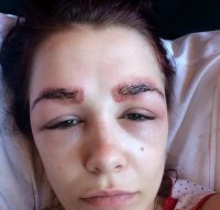 У меня одна знакомая пошла себе на жо_пе пиранью колоть в какой-то говно_салон. Эффект такой-же был. Через месяц зажило, но на пиранью смотреть без лошадиного ржача никто на пляже не мог.