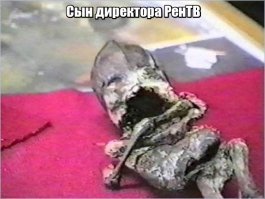 Кыштымский карлик Алешенька