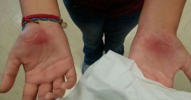 от онанизма, говорят, ещё и волосы на ладонях растут