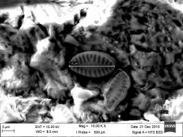 Стоит добавить, что электронный микроскоп выдает ч/б изображение и затем оно раскрашивается.
Доводилось играться с эл. микроскопом - очень круто!
1) Морская песчинка с обитателями - увеличение 2000х;
2) Обитатель длиной 7,4 микрометра - увеличение 10000х.